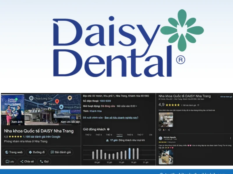 Teeth Whitening in Nha Trang