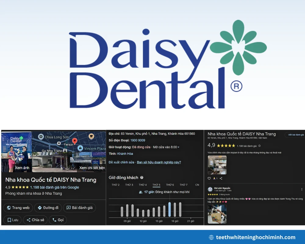 Top clinic teeth whitening in Nha Trang