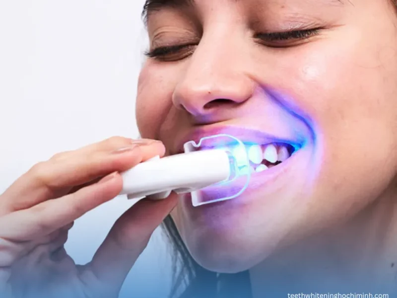 Teeth Whitening at Home