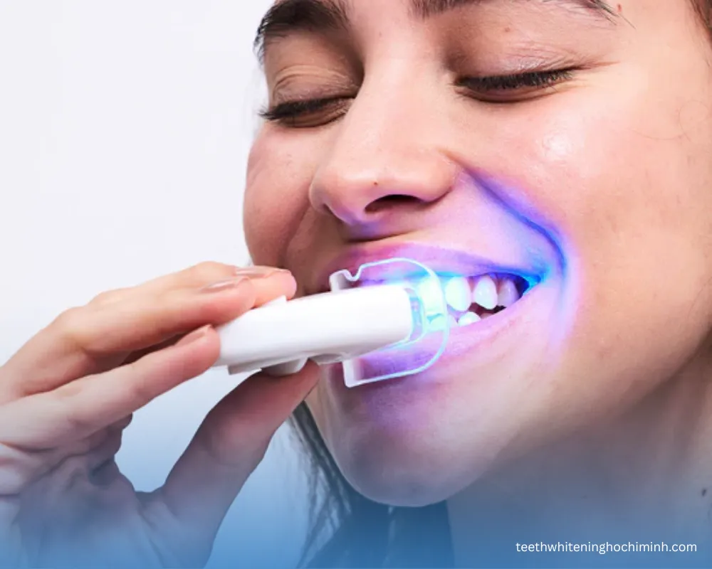 Teeth Whitening at Home