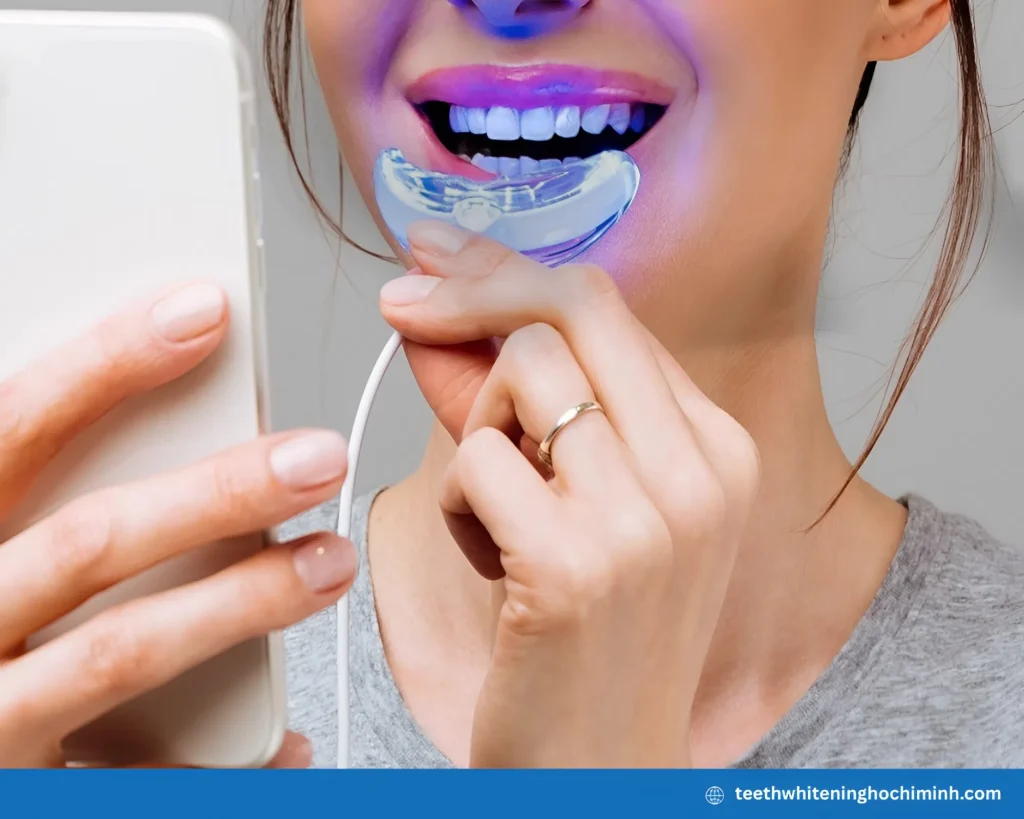 top teeth whitening treatments