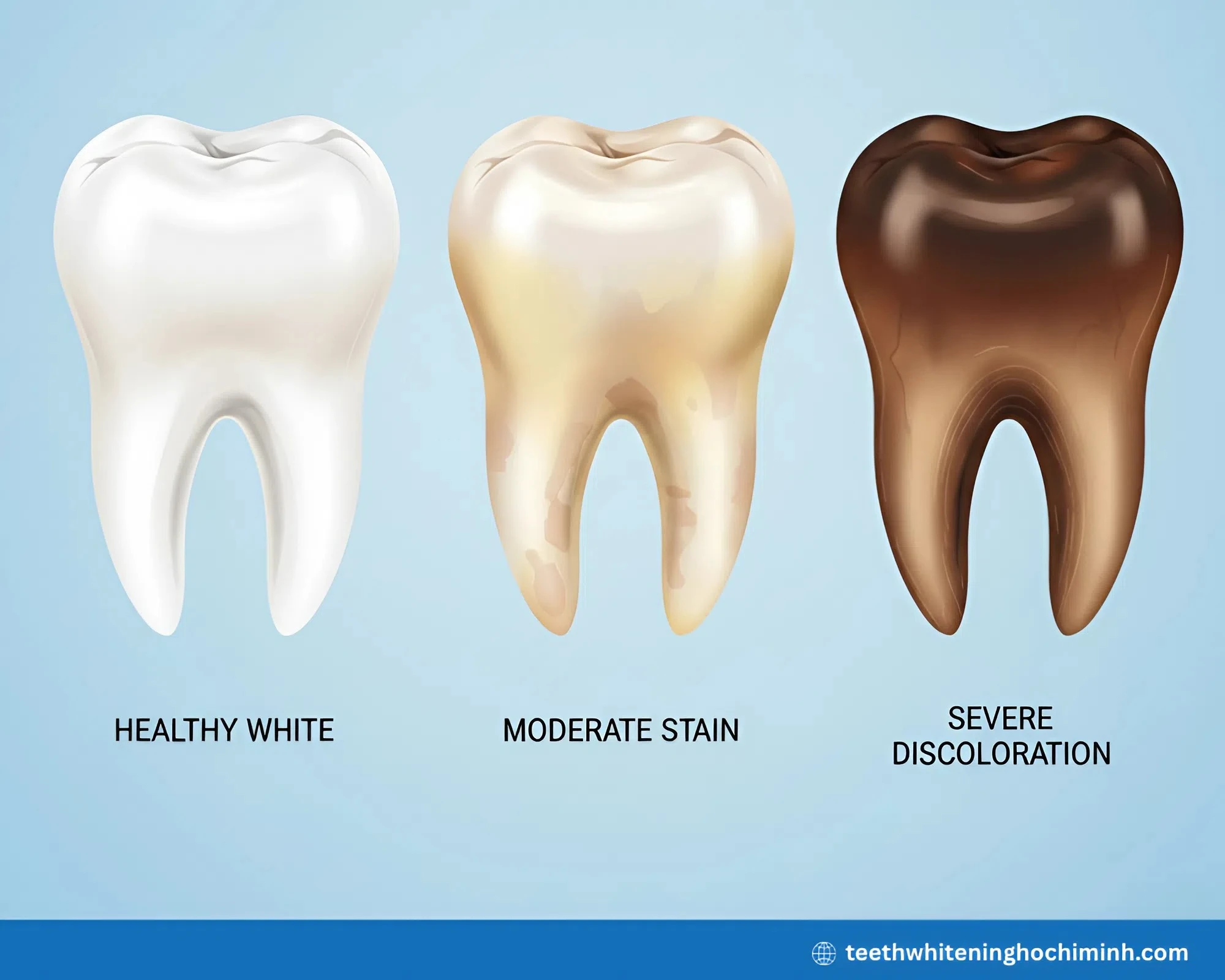 best teeth whitening procedure