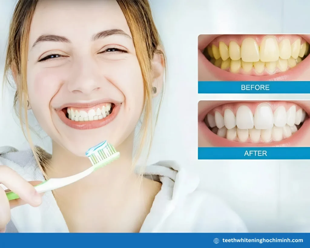 most effective teeth whitening