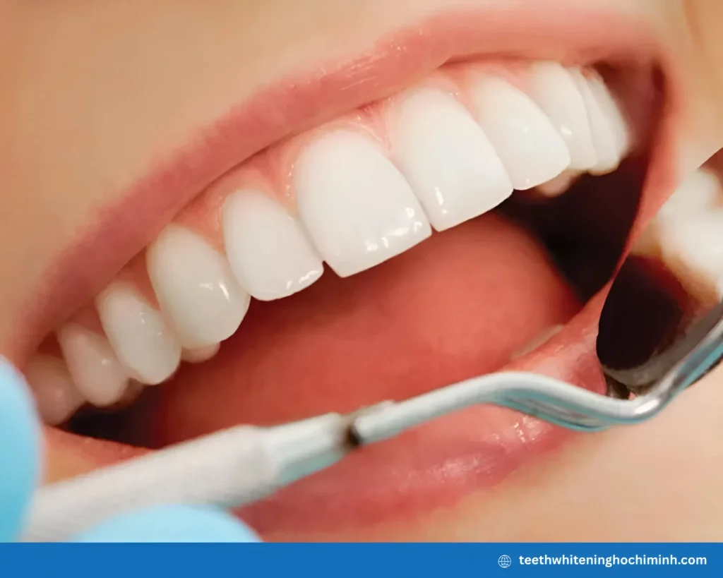 best cosmetic teeth whitening