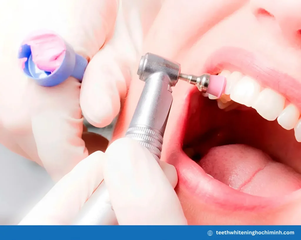 cosmetic teeth whitening price