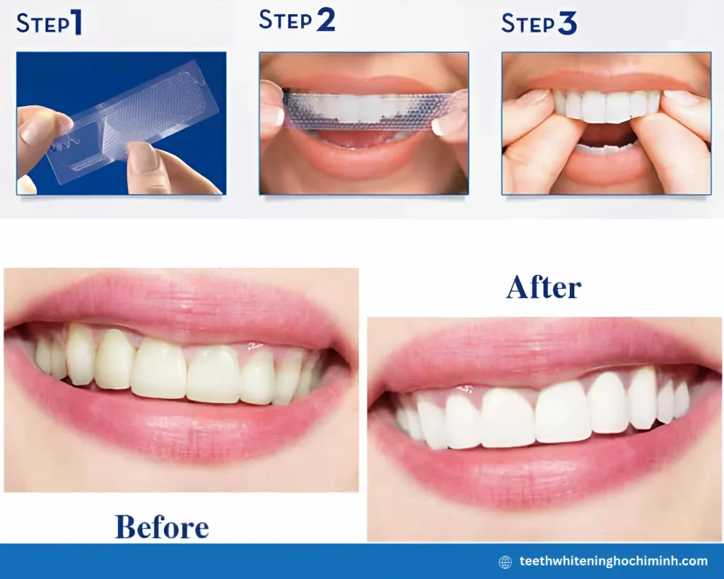 crest professional teeth whitening strips