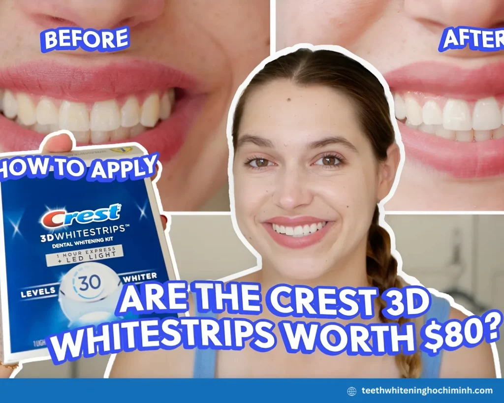 white crest teeth whitening strips