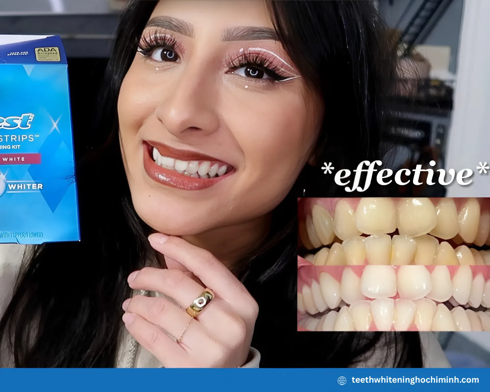crest teeth whitening strips