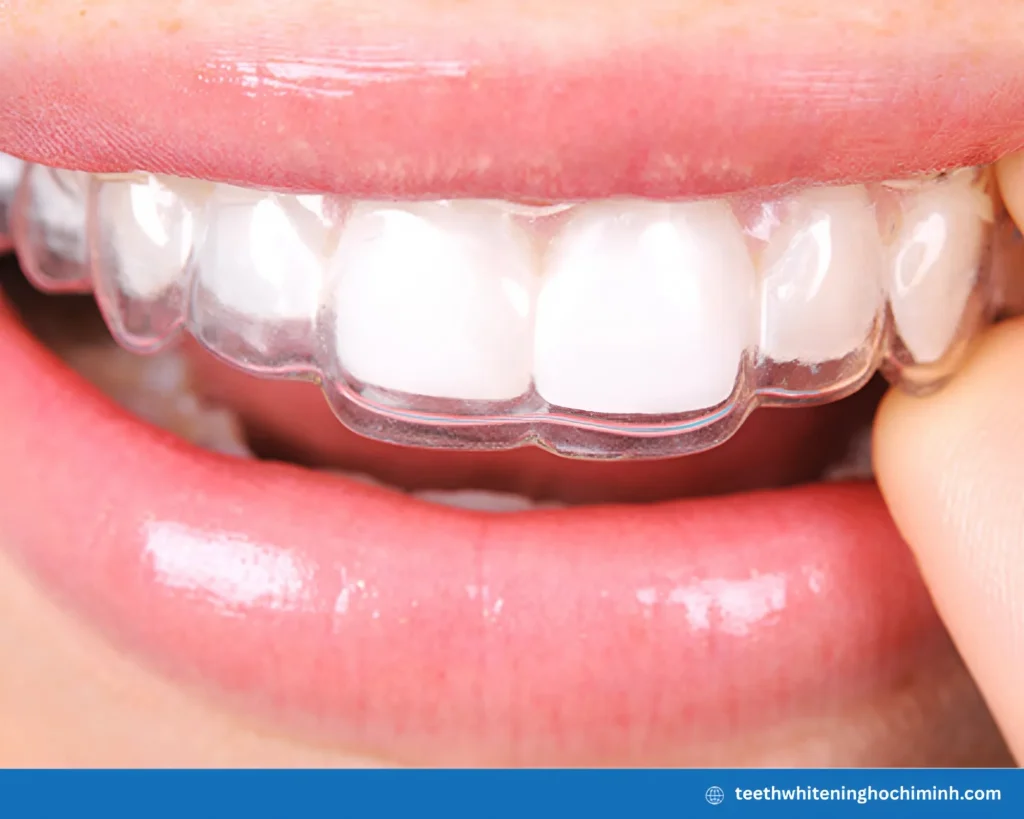 custom teeth whitening trays cost