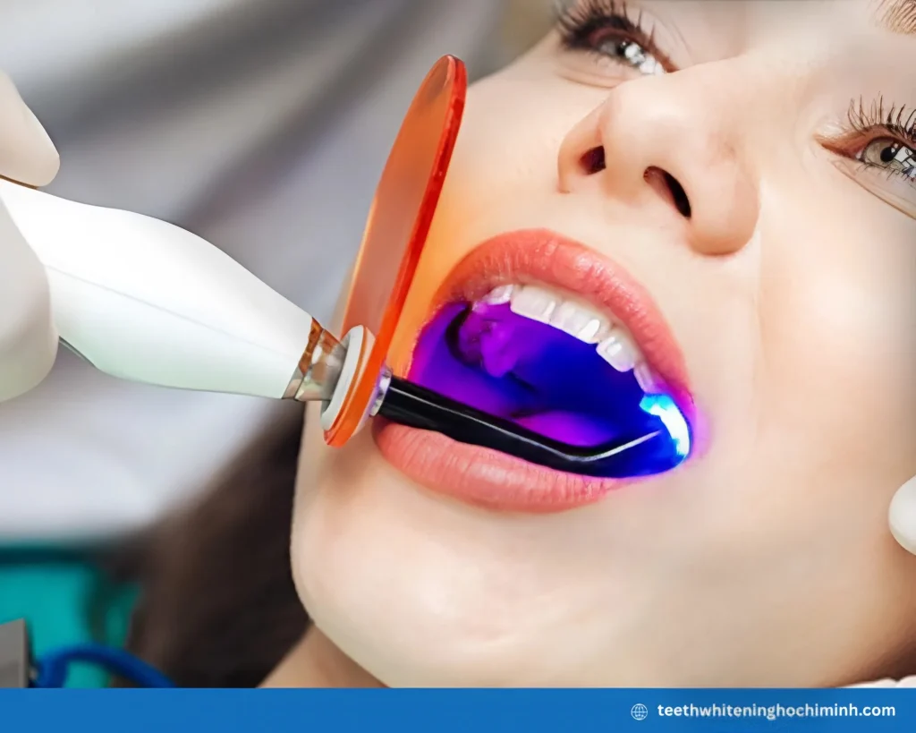 best safest teeth whitening