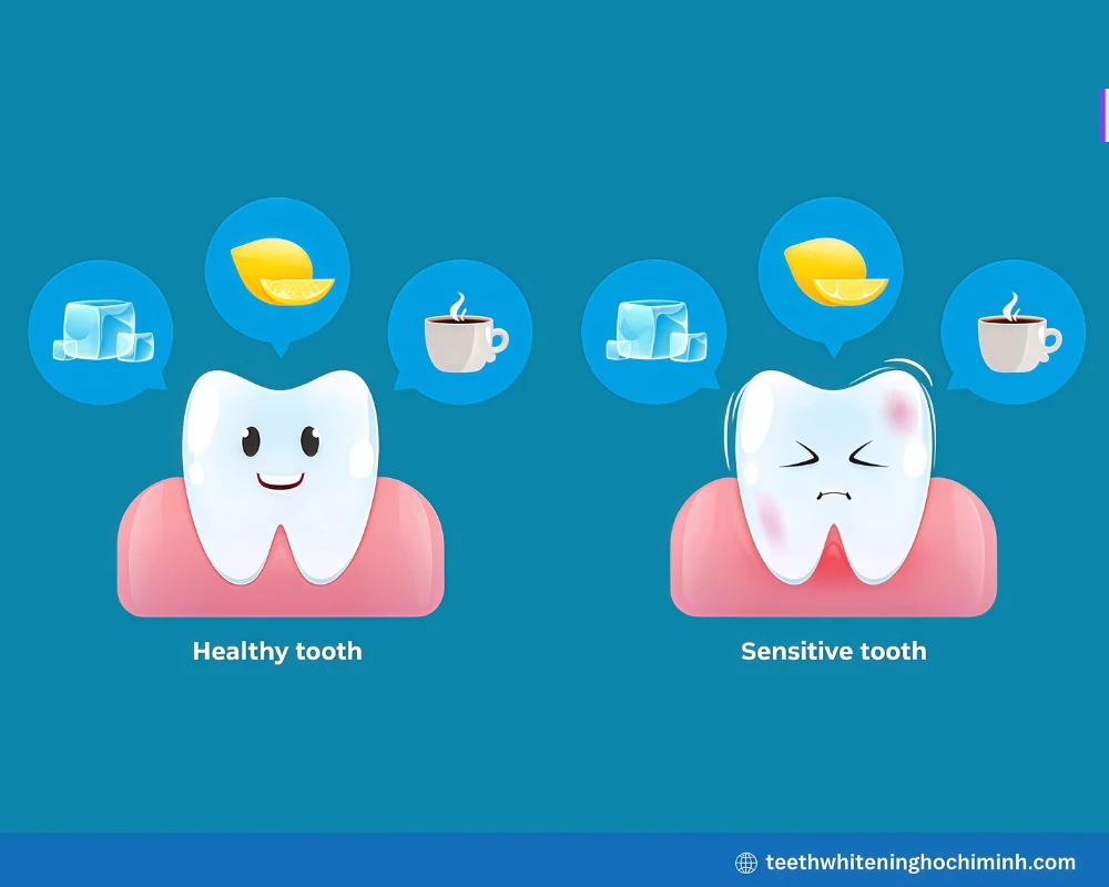 laser whitening of teeth