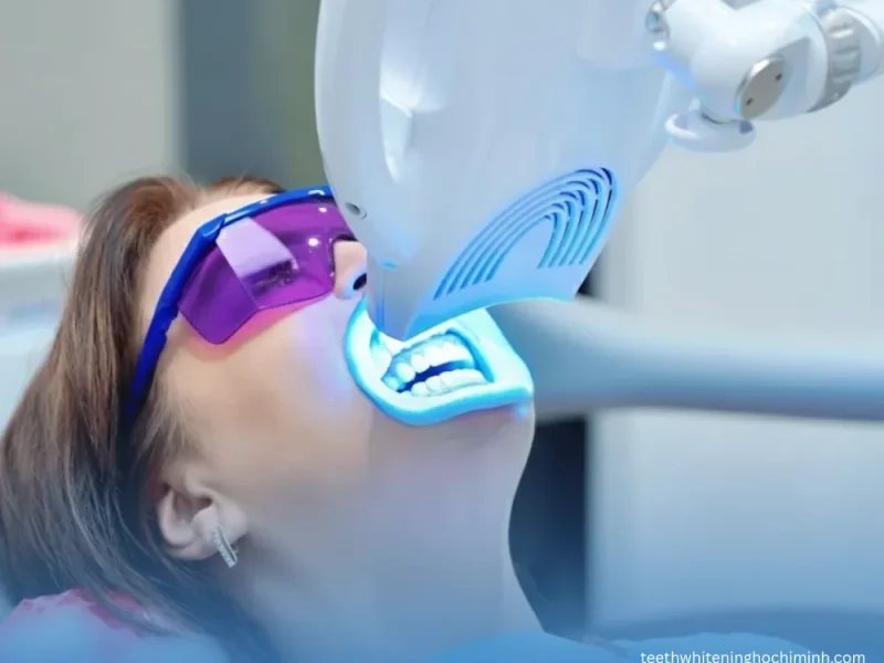 laser teeth whitening