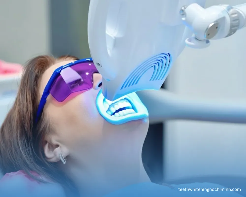 laser teeth whitening