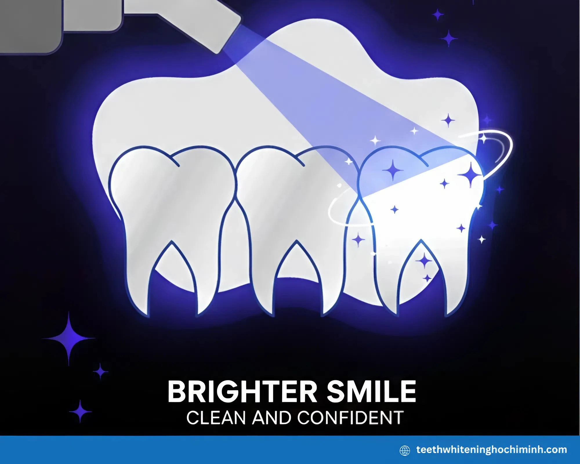 Laser Teeth Whitening Cost