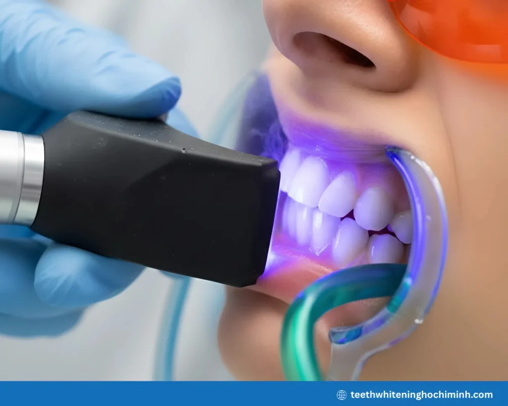 laser teeth whitening is it safe