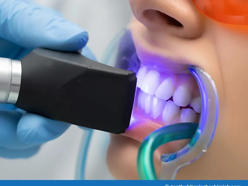 laser teeth whitening is it safe