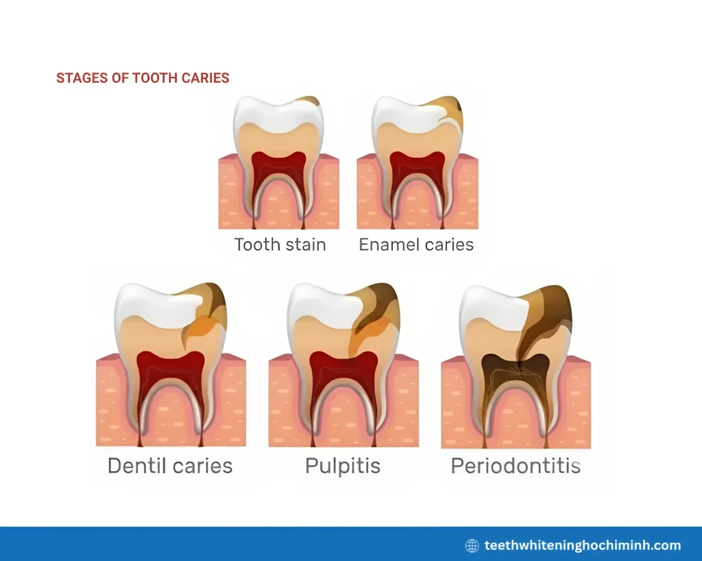 inflamed gum tissue