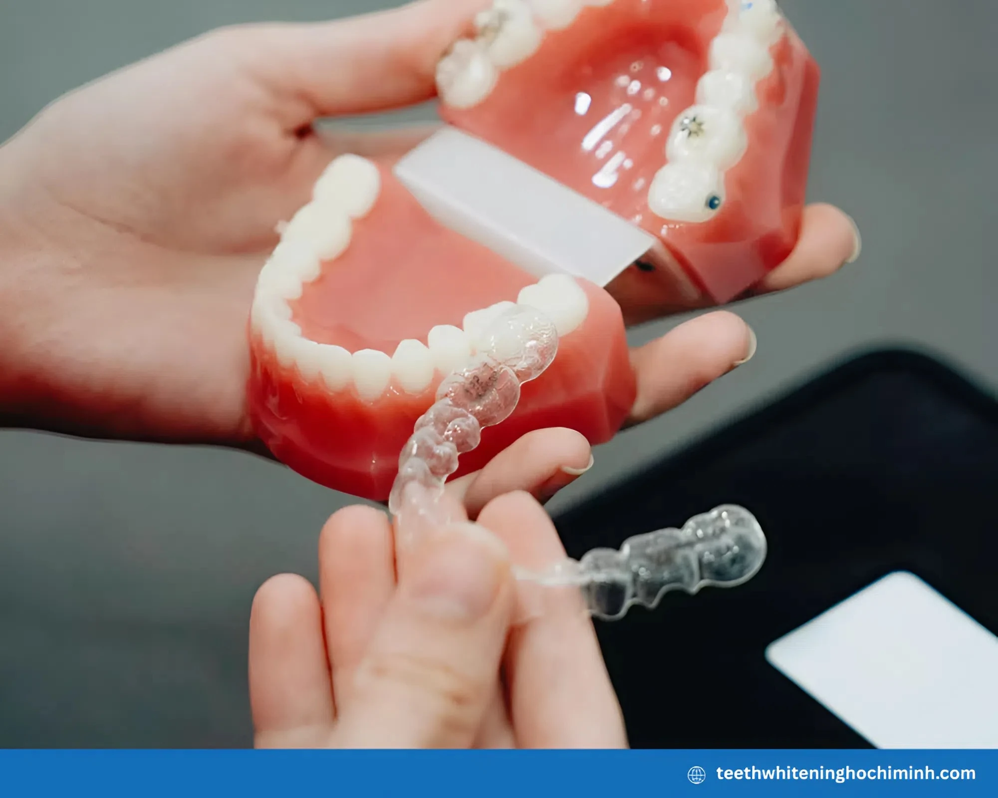 teeth whitening trays