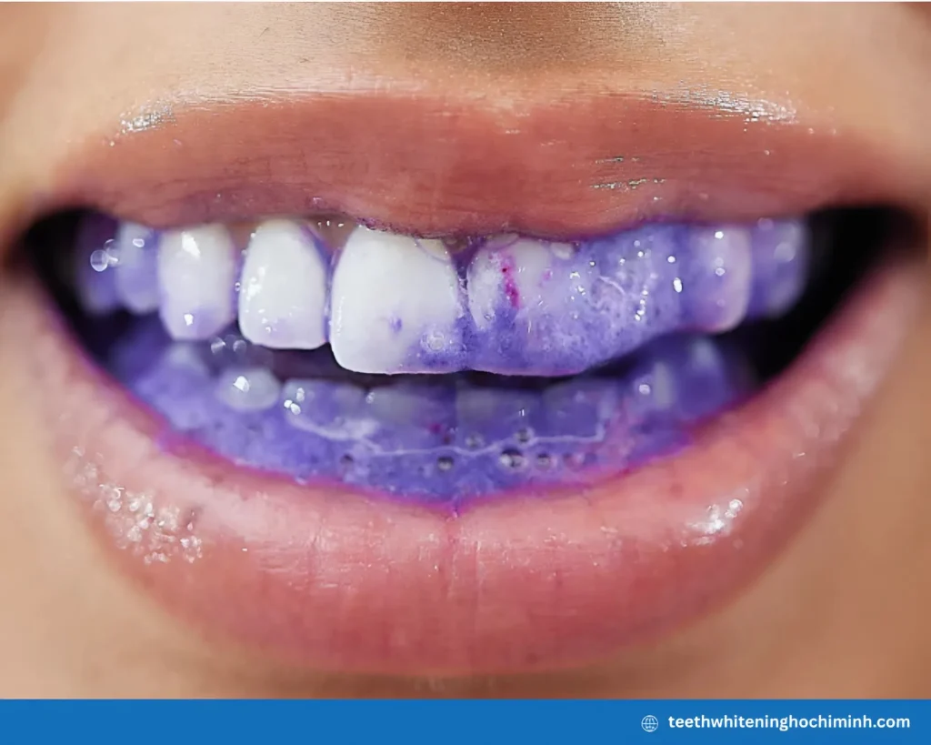 purple teeth whitening reviews