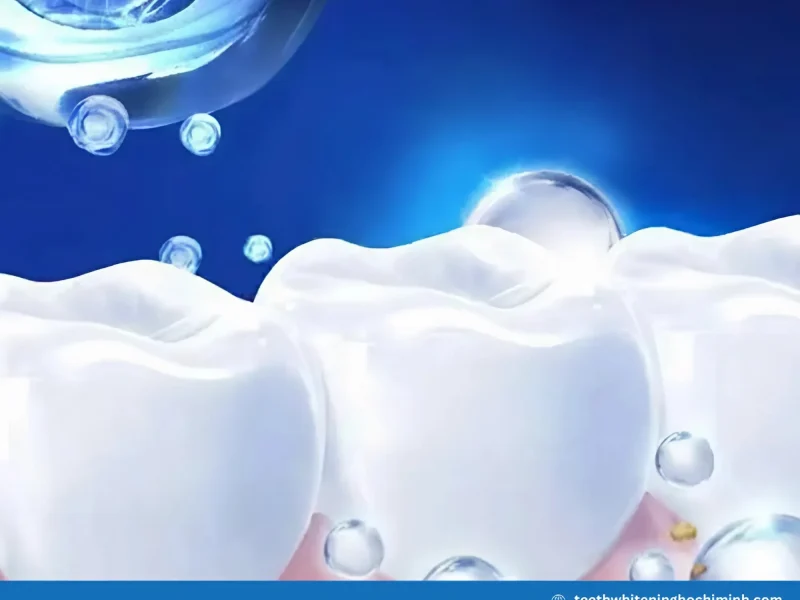 safe teeth whitening