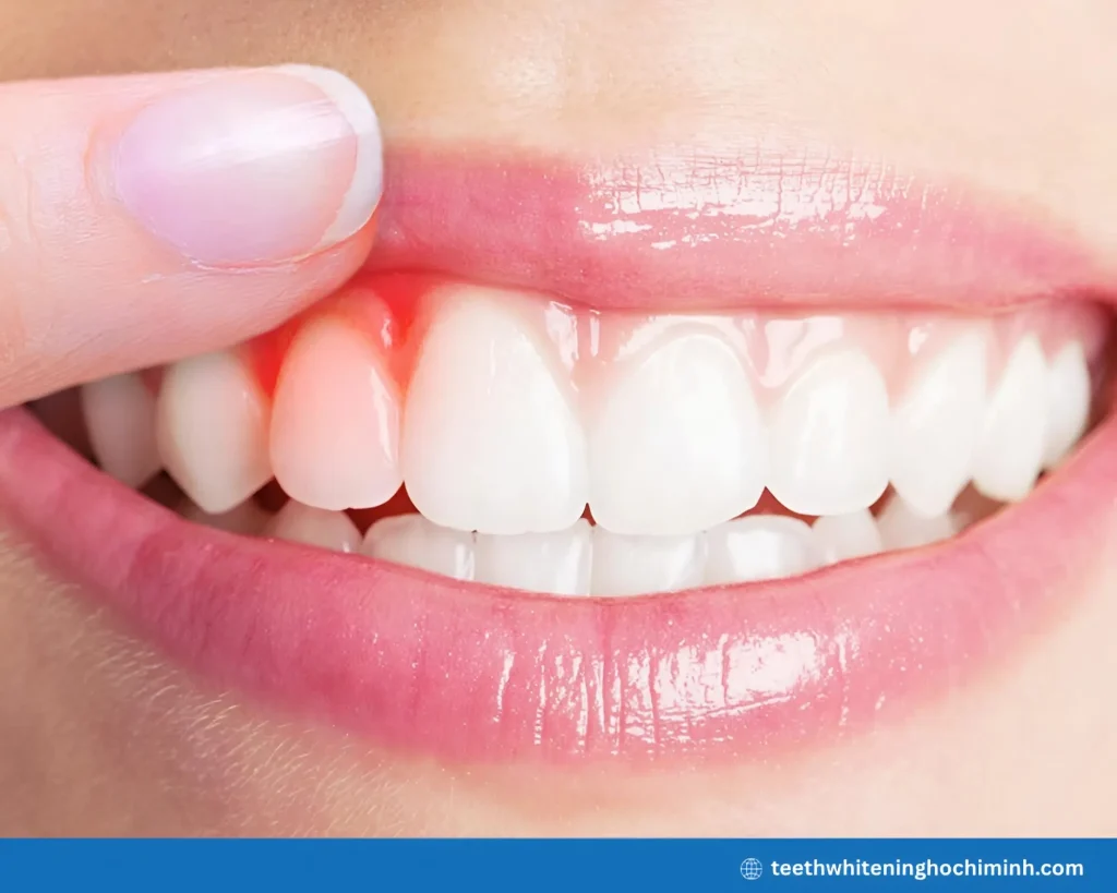 teeth whitening during pregnancy