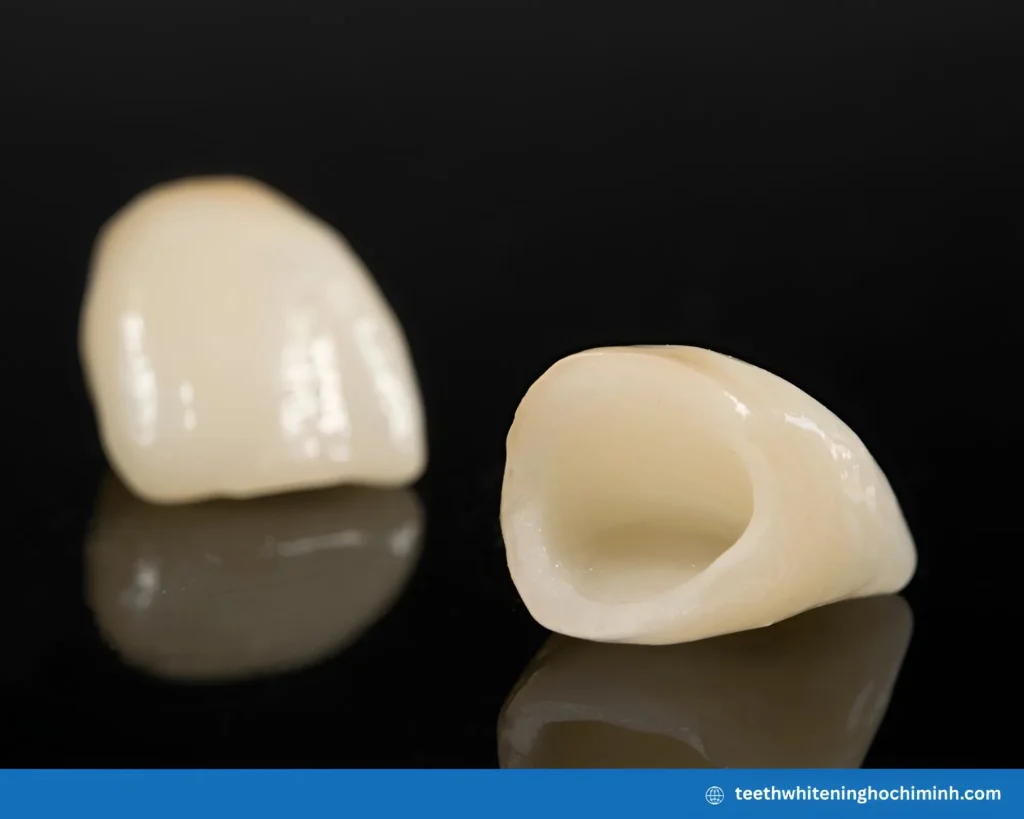 teeth whitening that whitens crowns