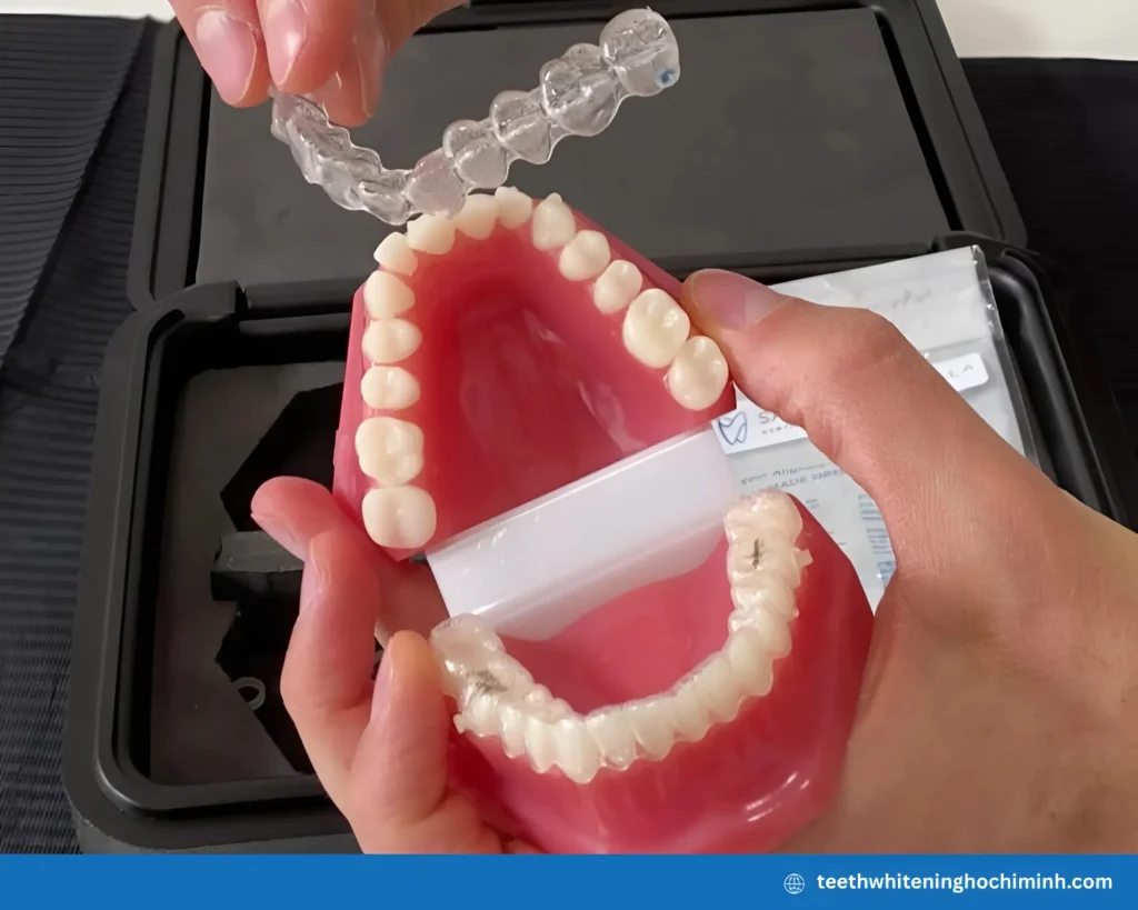 the best way to whiten teeth