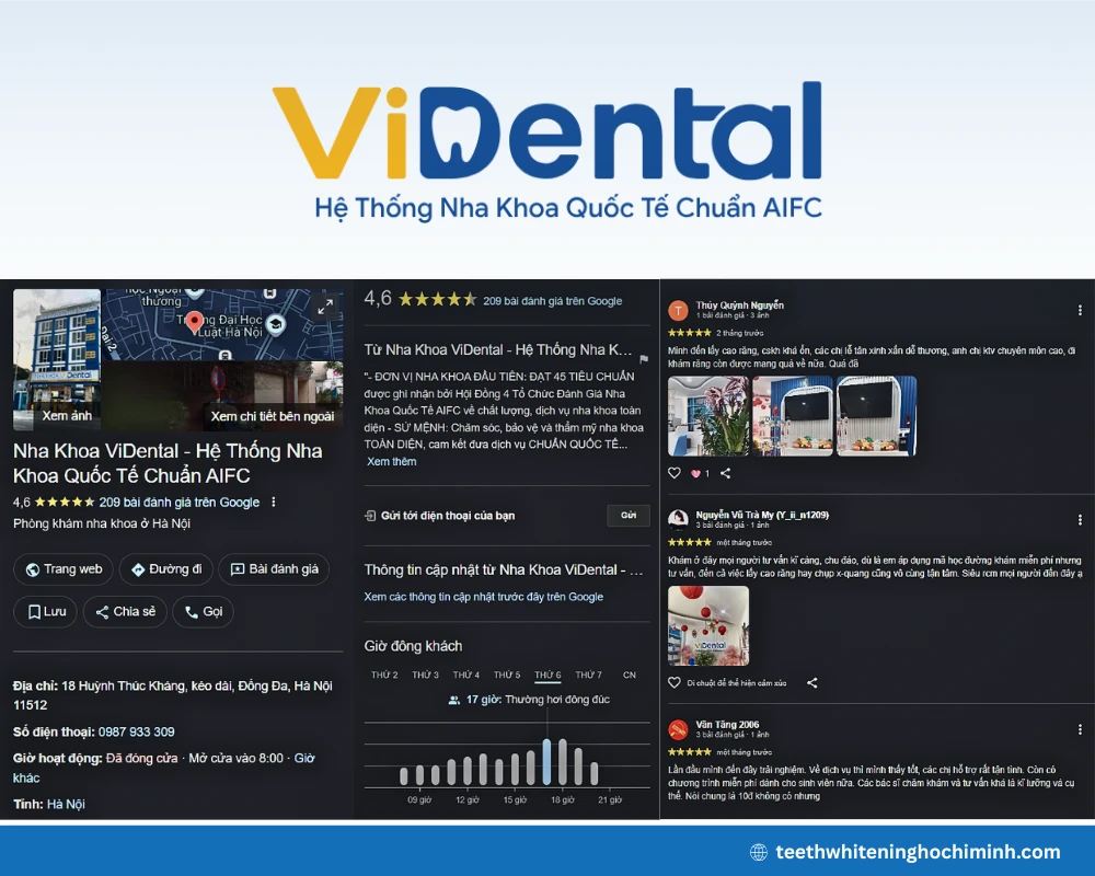 hanoi teeth whitening