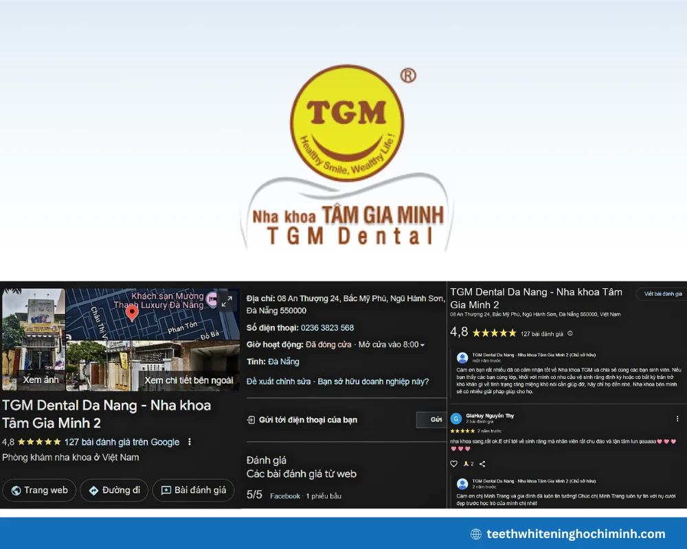 top teeth whitening clinic in da nang