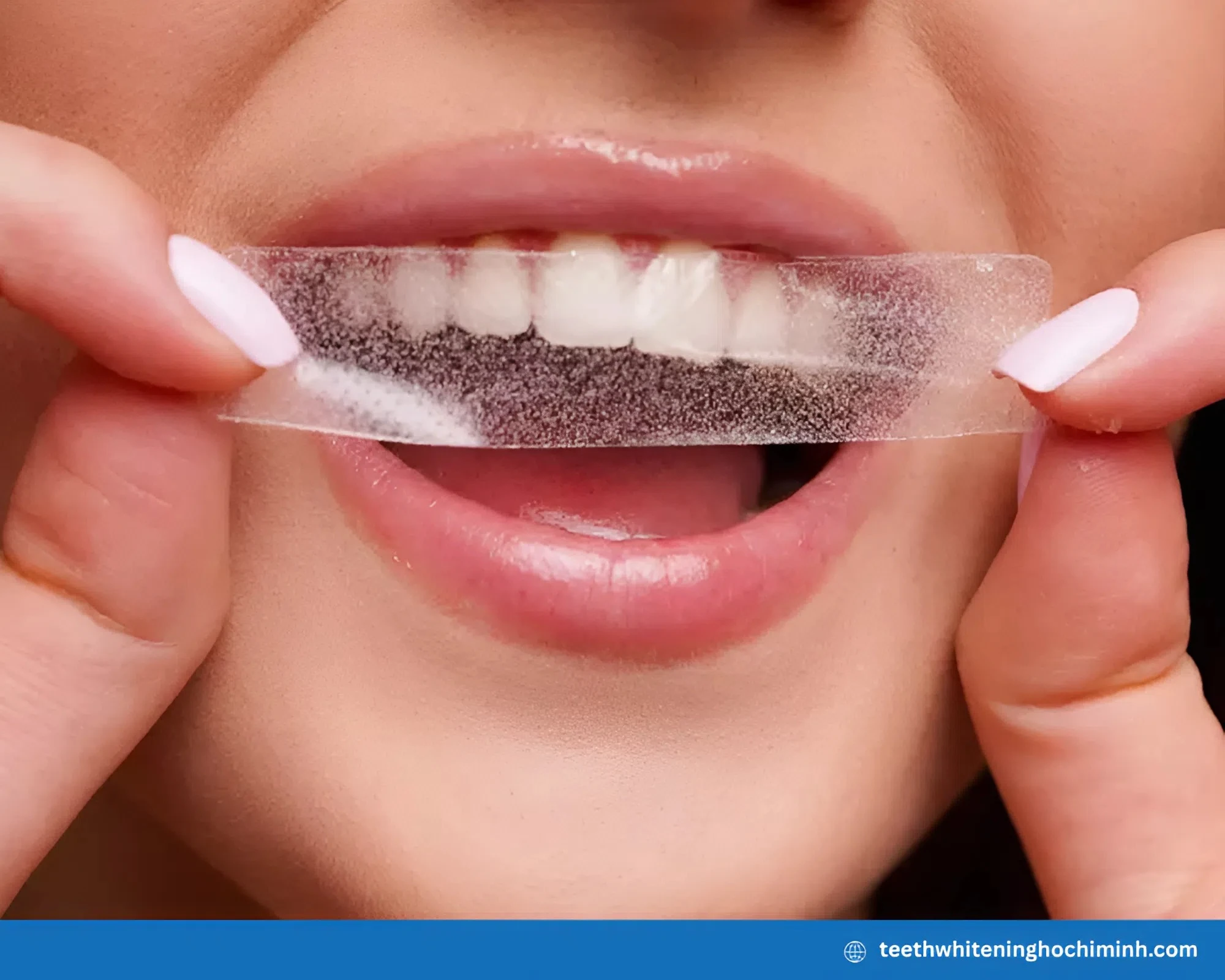 teeth whitening strips