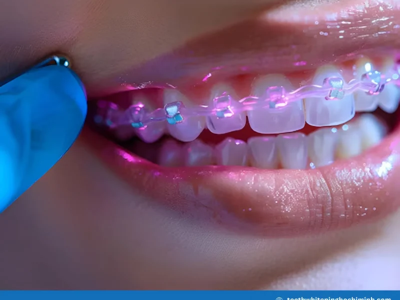 teeth whitening with braces