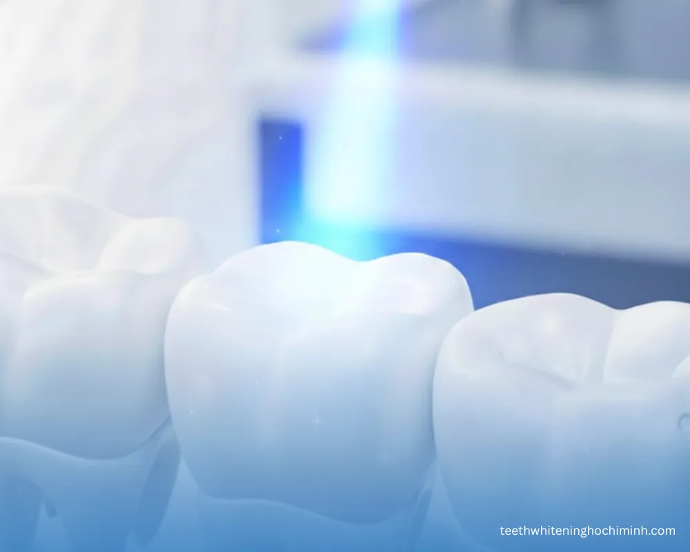 uv teeth whitening