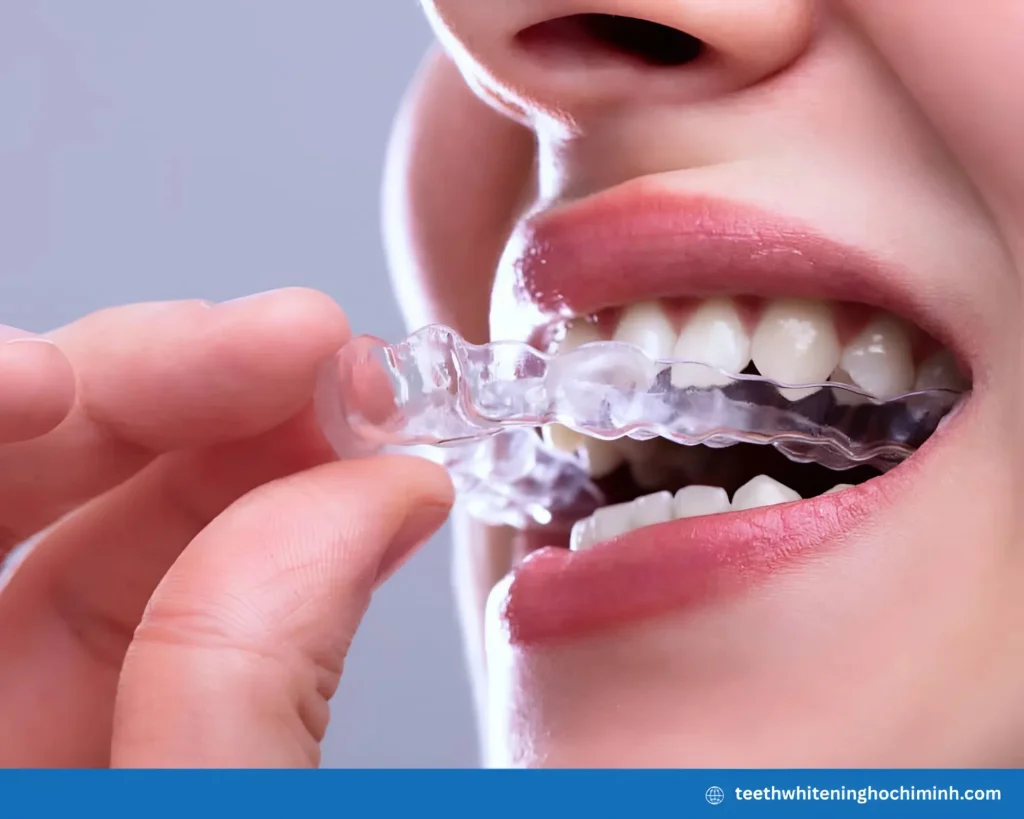 teeth whitening trays at home