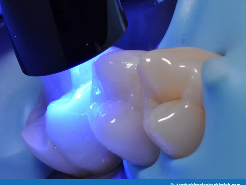 Zoom teeth whitening