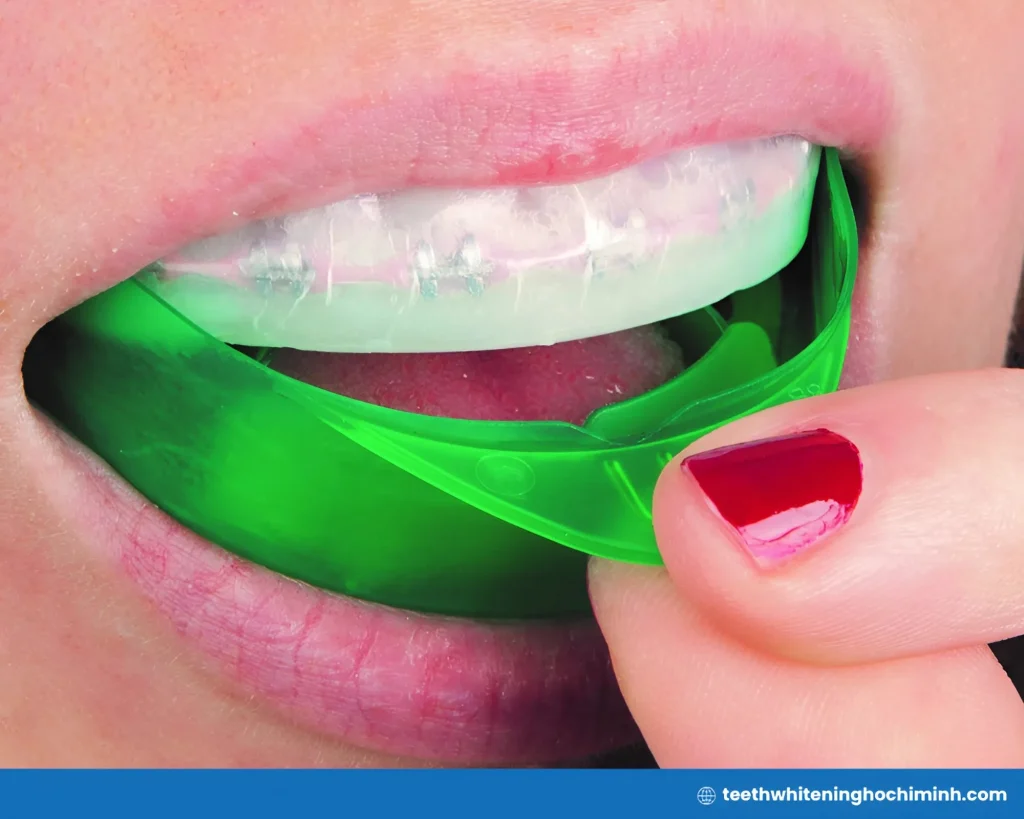 opalescence teeth whitening strips