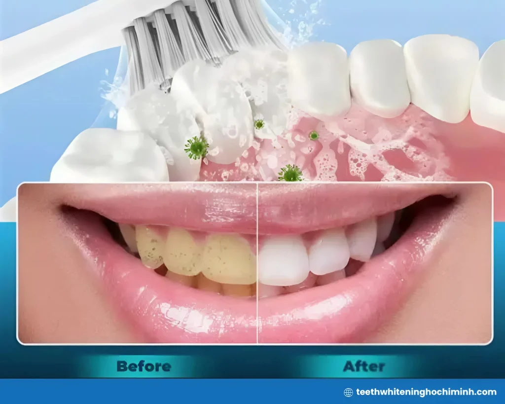 at home teeth whitening baking soda result