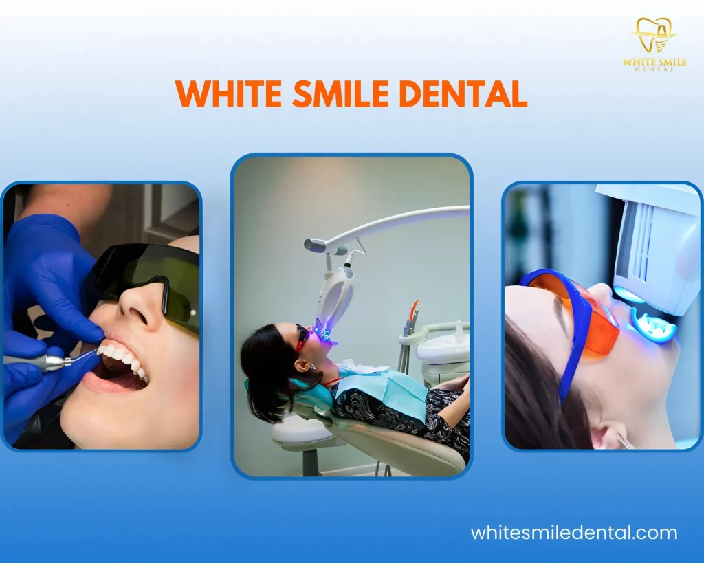 teeth whitening ho chi minh hot deal