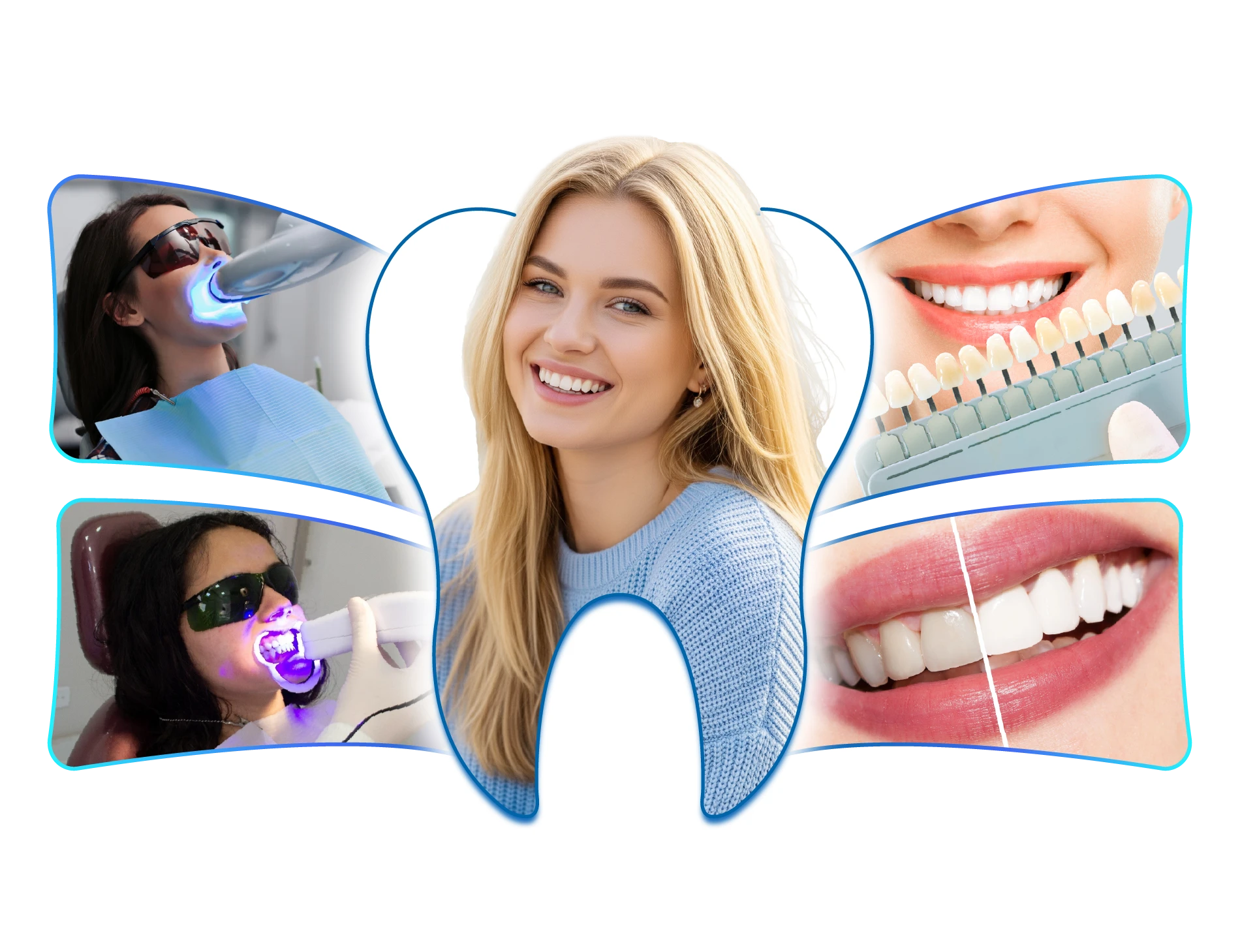 teeth whitening hochiminh