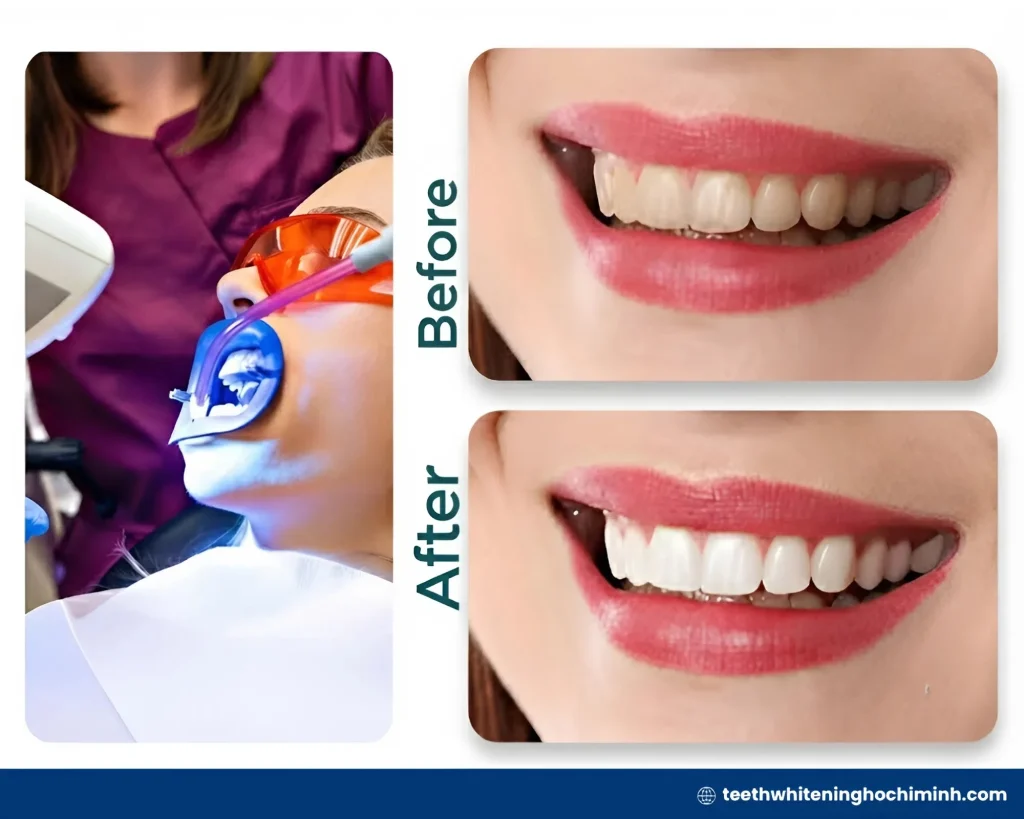 laser teeth treatment cost