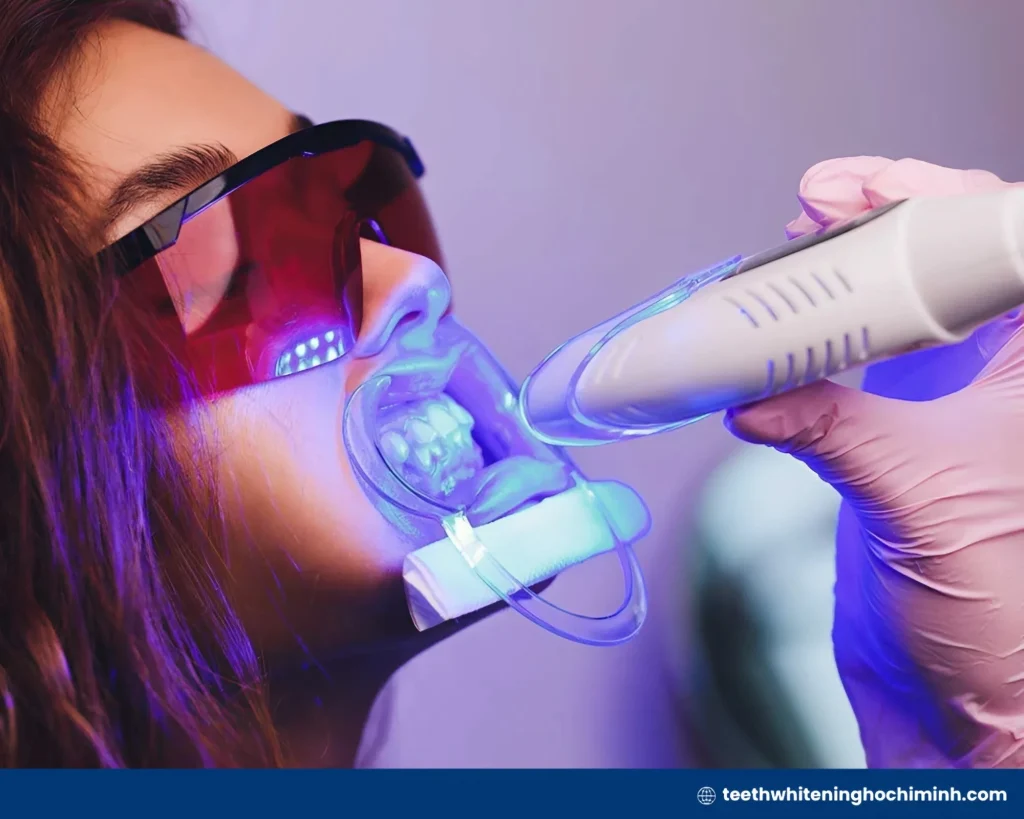 laser teeth whitening cost
