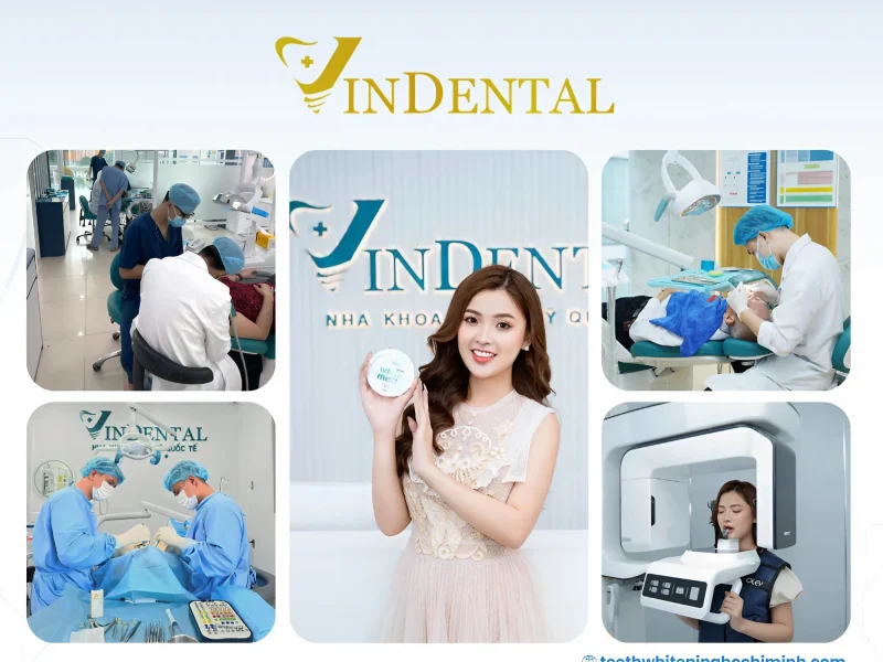 Teeth Whitening Clinics in Binh Thanh