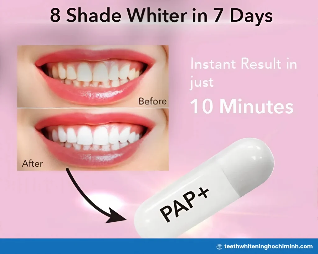 pap teeth whitening strips
