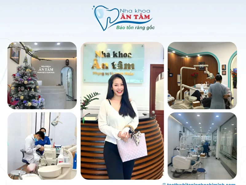 Teeth Whitening Clinics Tan Binh