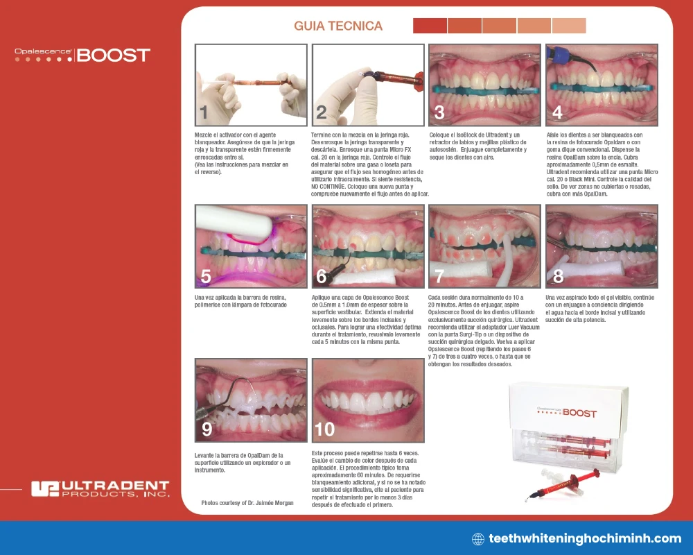 opalescence teeth whitening