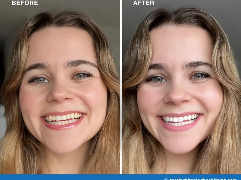 pola day teeth whitening