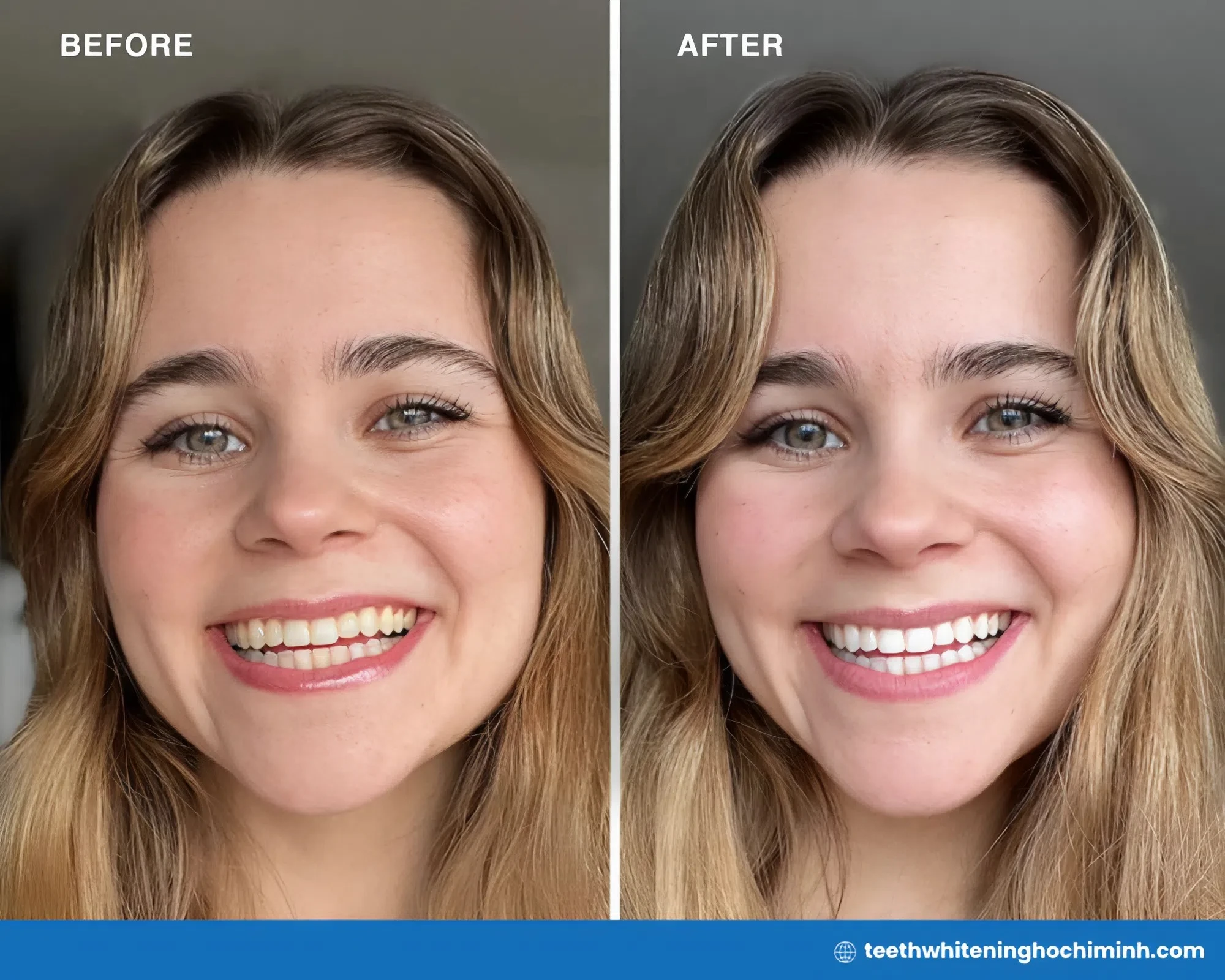 pola day teeth whitening