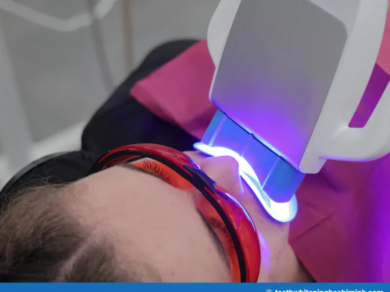 teeth whitening dentist