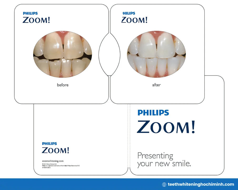 teeth whitening from dentist