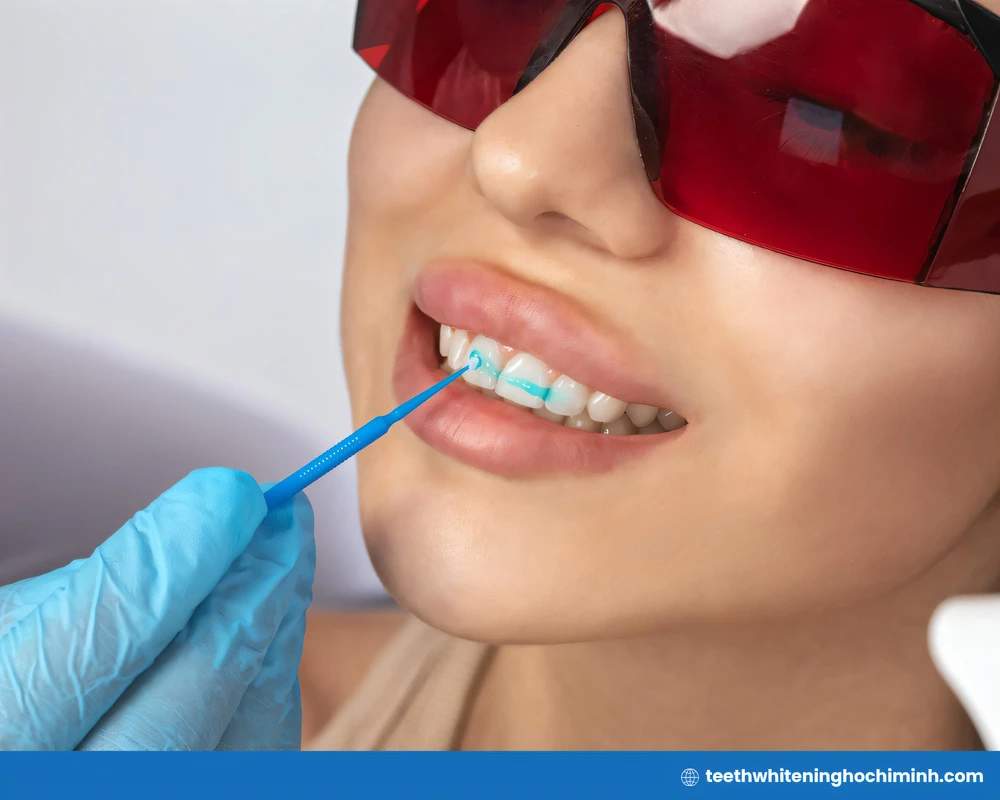 in-office teeth whitening ho chi minh vietnam