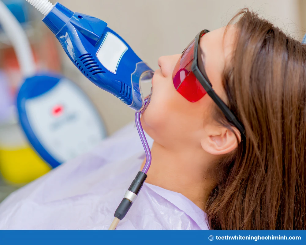 best teeth whitening in Ho Chi  Minh